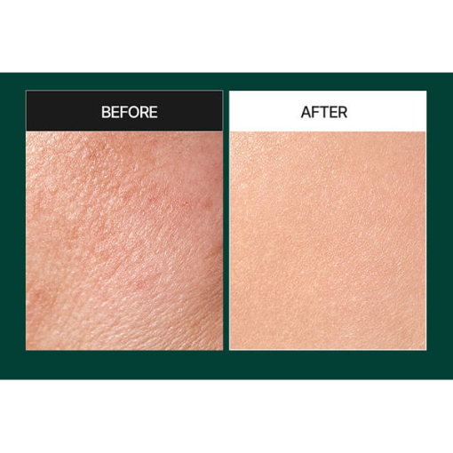 М'яка пілінг-сироватка зі спікулами та центелою MEDI-PEEL Phyto Cica-nol B5 3000 Shot Serum 50 мл